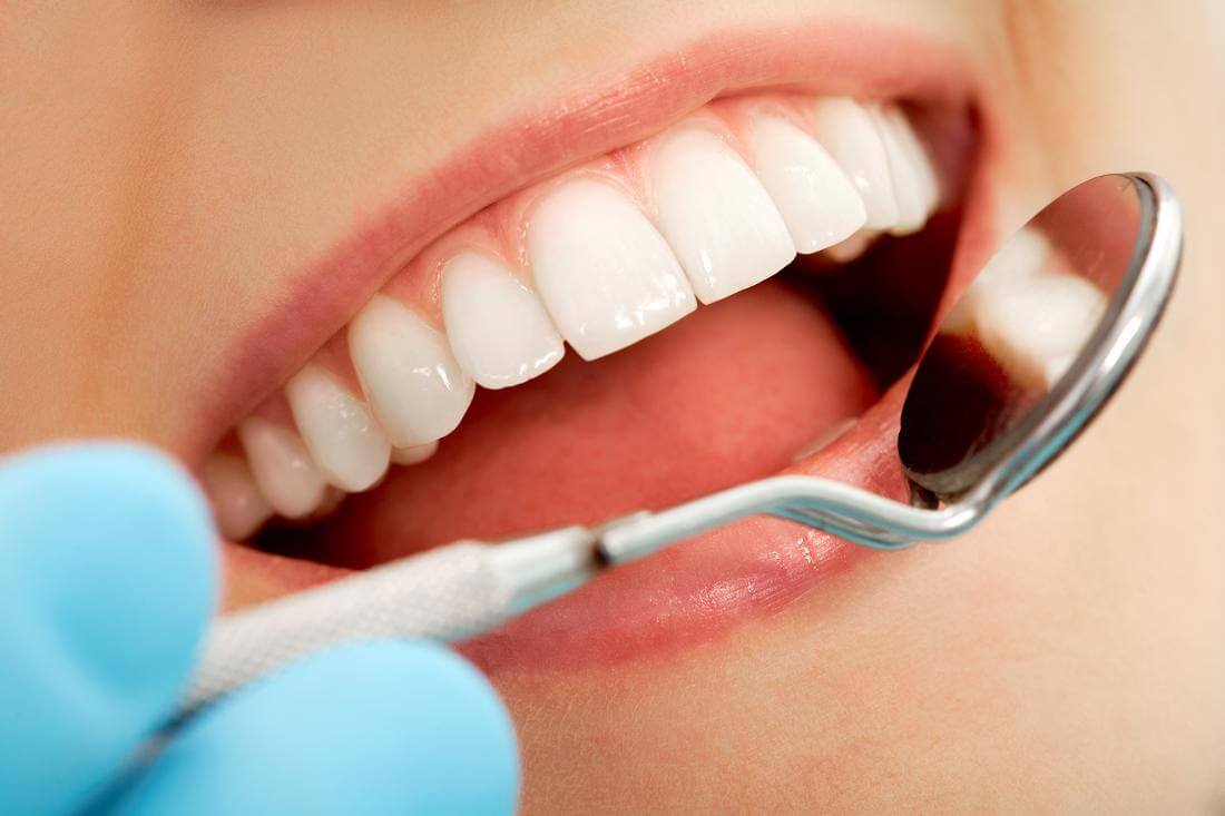 Американская стоматология: как недорого вылечить зубы в США — American Butler