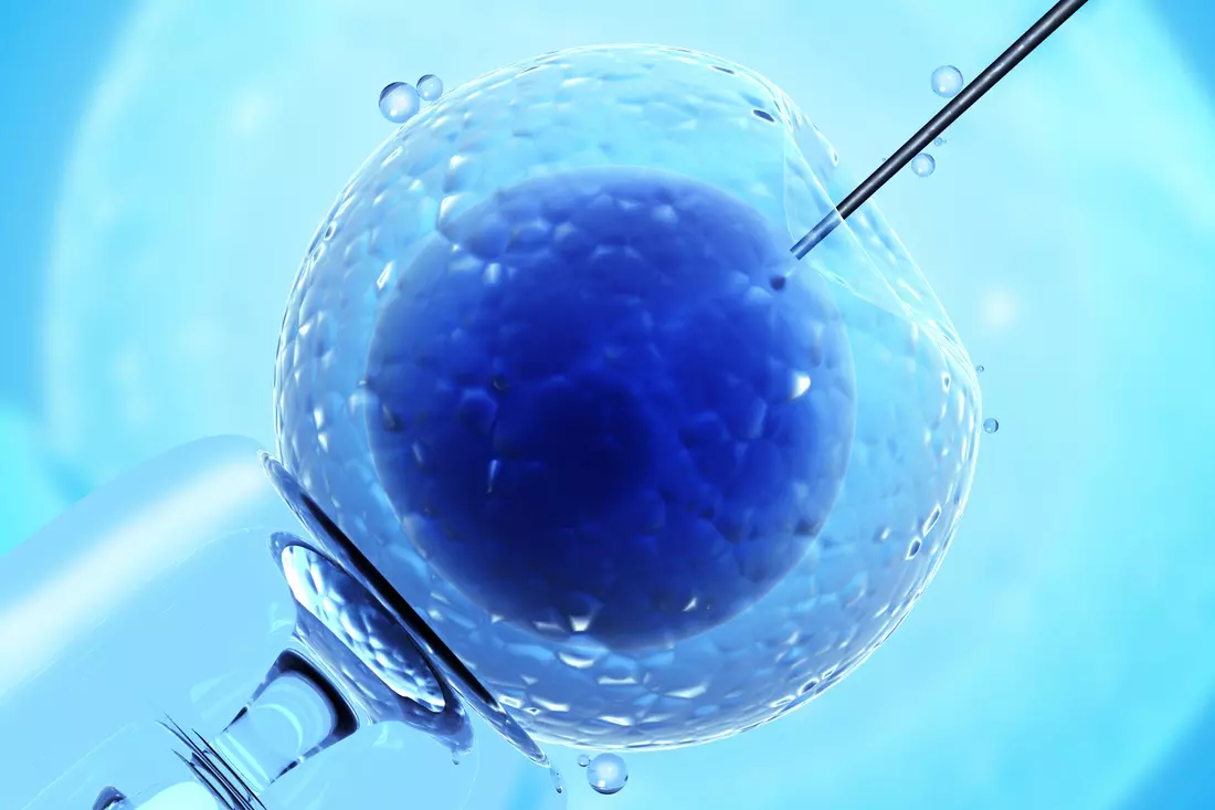 Picture of the injection of the solution into the egg during the IVF procedure in Miami