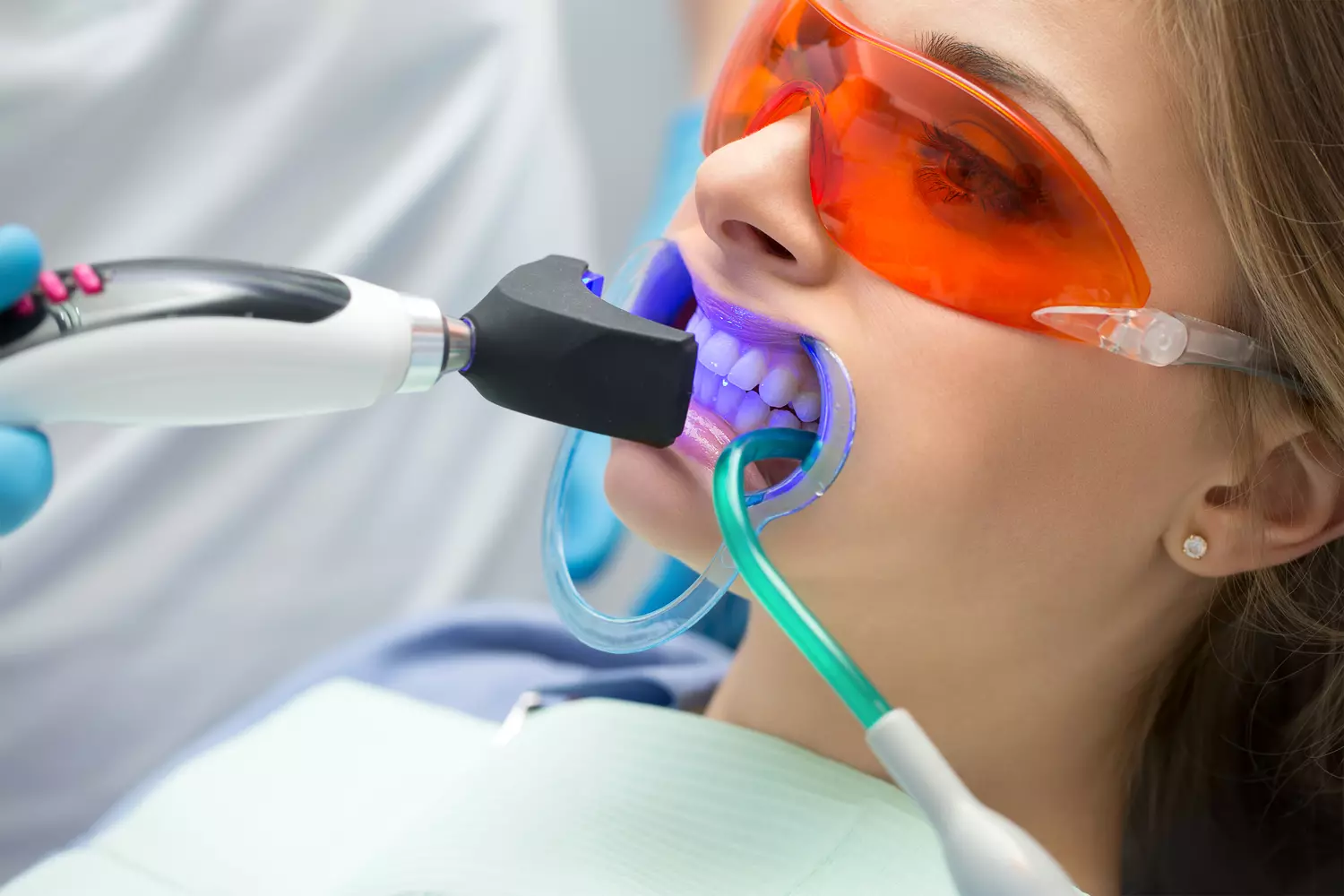 Photo of a girl on dental prosthetics in America — American Butler