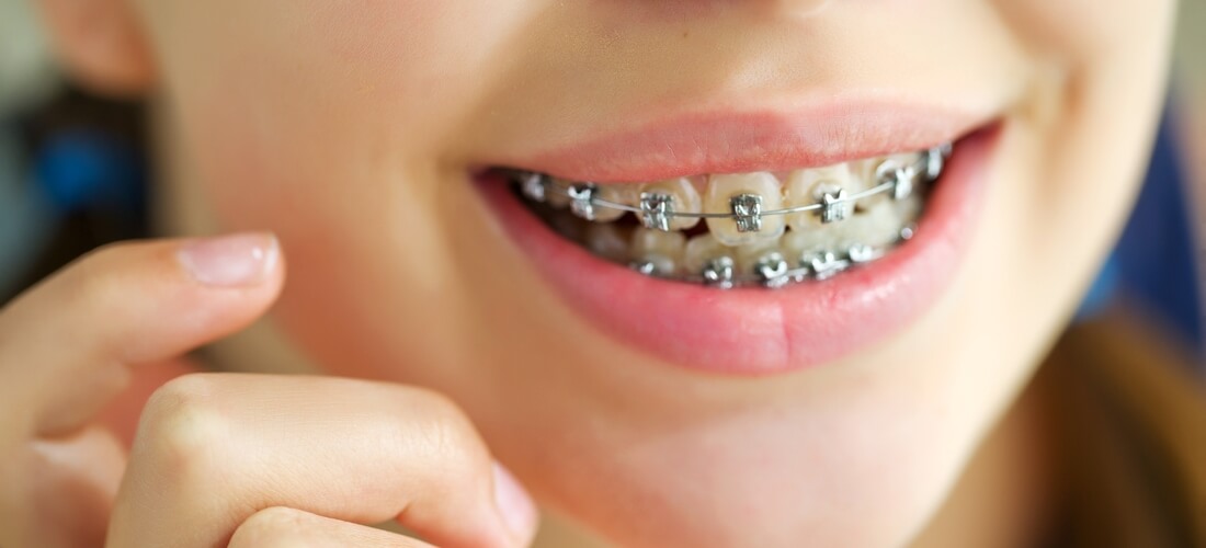 Dentists Miami — teeth straightening and alignment, implantation — American Butler