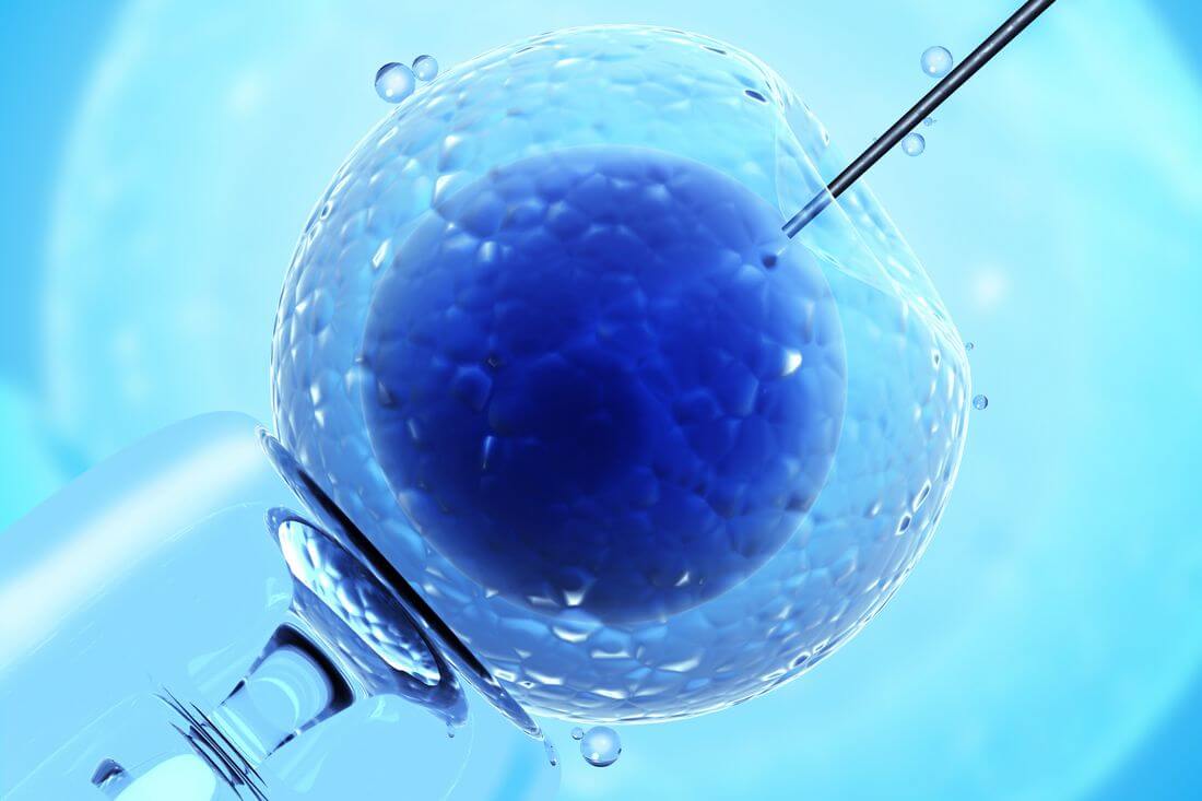 Photo of IVF in a laboratory in a clinic in Miami — American Butler